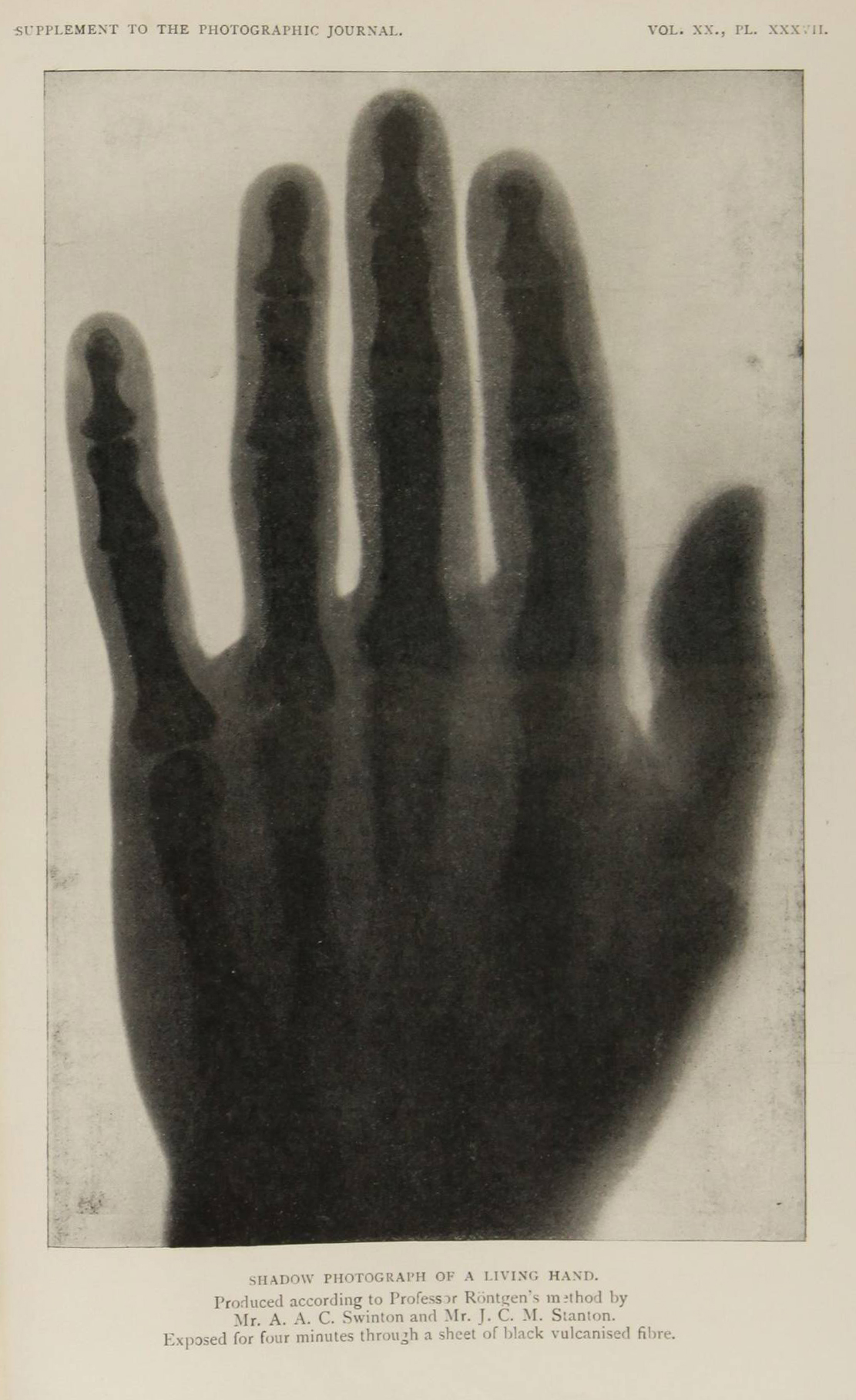 Shadow Photograph Of A Living Hand By Swinton