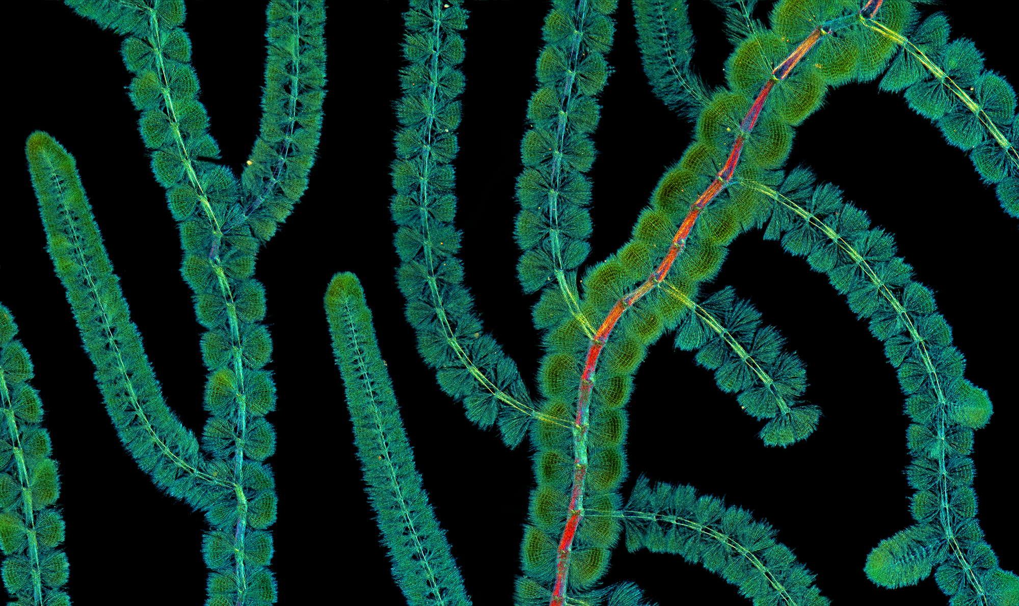 Micro 1St Marek Miś Batrachospermum Red Algae CUPOTY